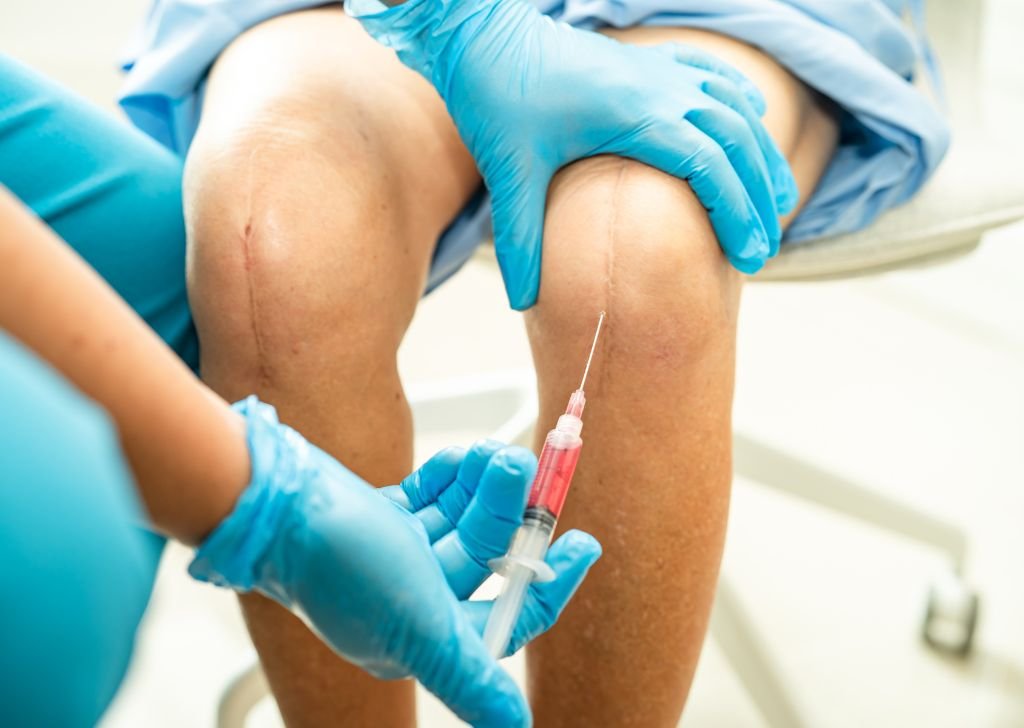 A doctor administering an injection for arthritis as a joint pain treatment.