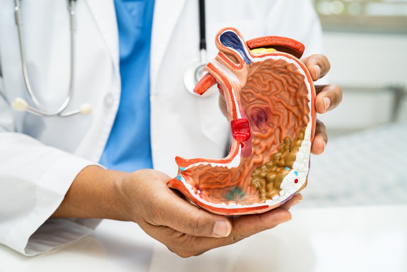 Mounjaro for Weight Loss in Sandakan 5 Stomach disease, doctor with anatomy model for study diagnosis a