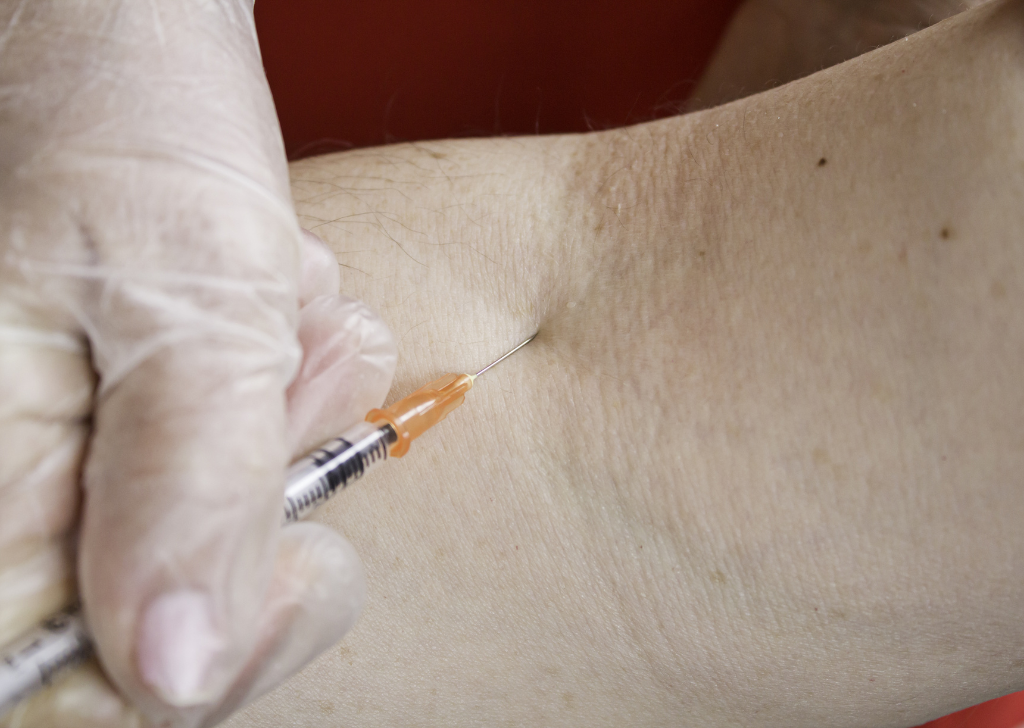 Joint pain injection in Sandakan, Sabah.