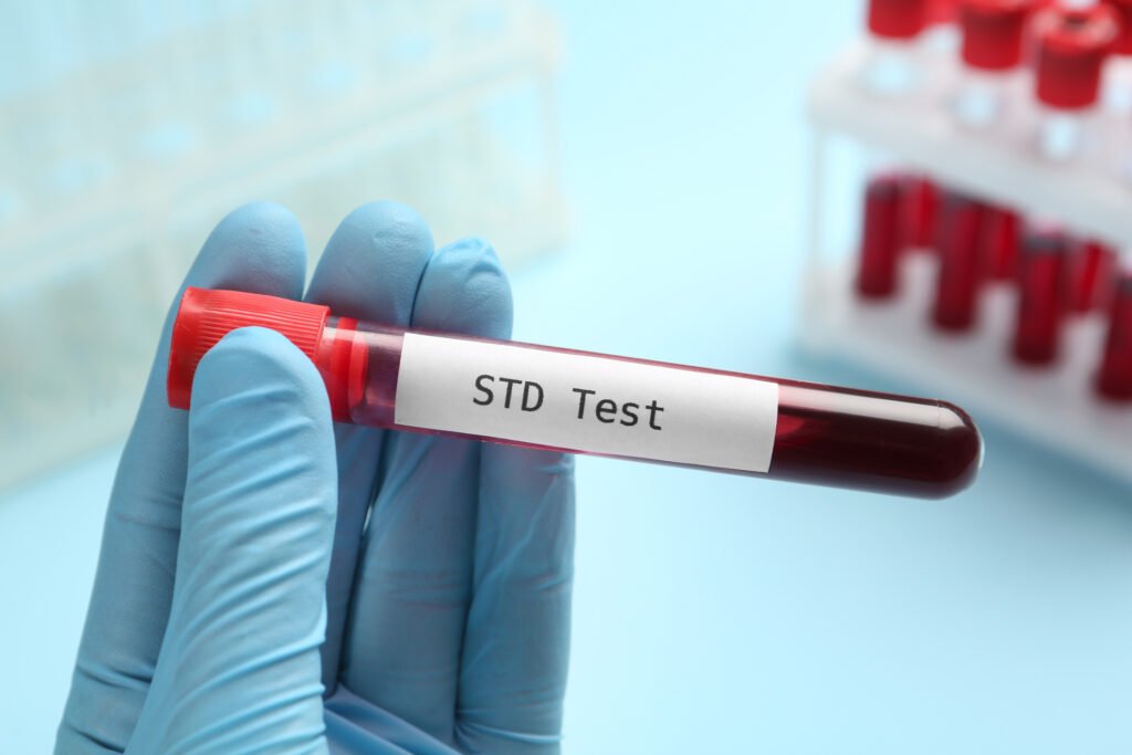 std blood test