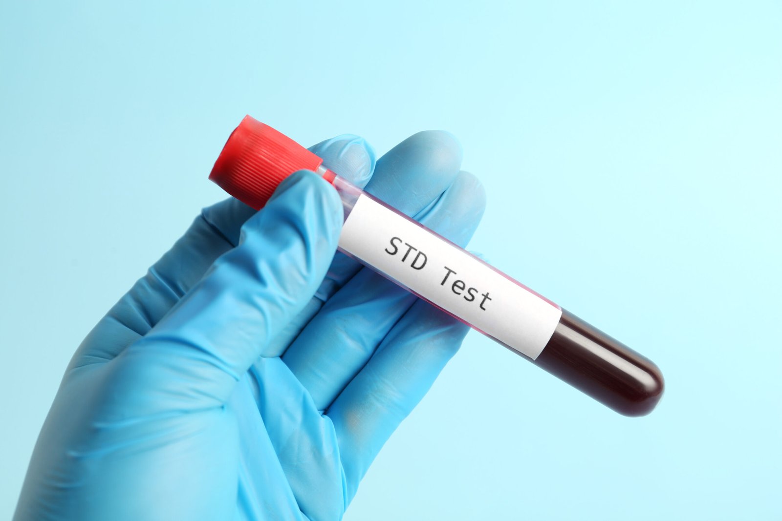STD checkup
