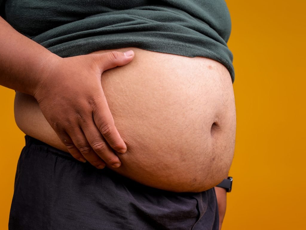 Overweight Problem. Man With Excessive Belly Fat on Yellow Background. Overweight Problem. Man With Excessive Belly Fat on Yellow Background.