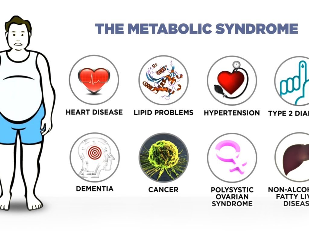 symptoms-metabolic-syndrome-obesity-high-blood-pressure-glucose-intolerance-high-cholesterol-Orlando symptoms-metabolic-syndrome-obesity-high-blood-pressure-glucose-intolerance-high-cholesterol-Orlando